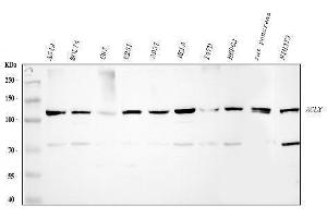 Western blot analysis of ACLY using anti-ACLY antibody (ABIN4886416). (ACLY 抗体  (AA 1-180))