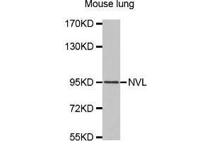 Western Blotting (WB) image for anti-Nuclear VCP-Like (NVL) antibody (ABIN1875763) (NVL 抗体)