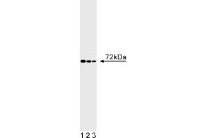 Western Blotting (WB) image for anti-IL2-Inducible T-Cell Kinase (ITK) (AA 1-26) antibody (ABIN967287) (ITK 抗体  (AA 1-26))