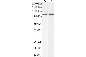 Phospholipase C delta 3 抗体  (AA 261-274)