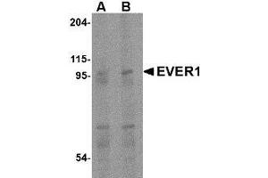 Western blot analysis of EVER1 in human spleen tissue lysate with AP30322PU-N EVER1 antibody at (A) 1 and (B) 2 μg/ml. (TMC6 抗体  (Center))