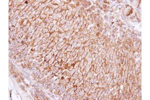 IHC-P Image Immunohistochemical analysis of paraffin-embedded human adrenal gland, using SCAMP3, antibody at 1:100 dilution. (SCAMP3 抗体)