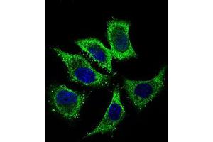 Immunofluorescence analysis of HepG2 cells using ALDH2 mouse mAb (green).