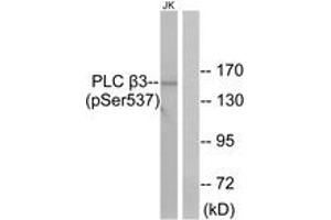 Western blot analysis of extracts from Jurkat cells treated with UV 15', using PLC beta3 (Phospho-Ser537) Antibody. (PLCB3 抗体  (pSer537))