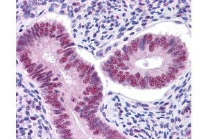 Immunohistochemistry (IHC) image for anti-Signal Transducer and Activator of Transcription 3 (Acute-Phase Response Factor) (STAT3) (Middle Region) antibody (ABIN504617) (STAT3 抗体  (Middle Region))