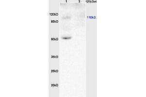 L1 rat brain lysates L2 human colon carcinoma lysates probed with Anti KLF5/UKHC Polyclonal Antibody, Unconjugated (ABIN739515) at 1:200 overnight at 4 °C. (KLF5 抗体  (AA 61-160))