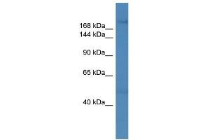 WB Suggested Anti-ZNF142 Antibody Titration: 0. (ZNF142 抗体  (C-Term))