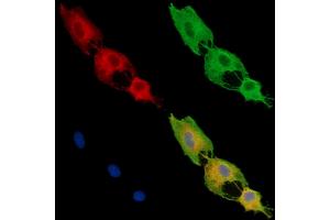 ABIN7096031 and ABIN7100093 staining  cells by IF/ICC. (DENND1A 抗体)