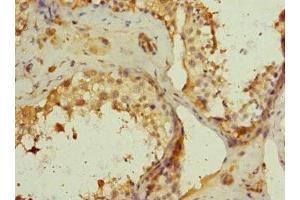 Immunohistochemistry (IHC) image for anti-Mannose Receptor, C Type 2 (MRC2) (AA 120-300) antibody (ABIN7146098)