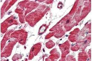 Human Heart (formalin-fixed, paraffin-embedded) stained with Heat Shock Protein 27 (HSP27) antibody ABIN462101 at 10 ug/ml followed by biotinylated goat anti-rabbit IgG secondary antibody ABIN481713, alkaline phosphatase-streptavidin and chromogen. (HSP27 抗体)