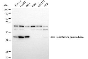 Western blotting analysis using cystathionine gamma-lyase antibody (ABIN7798234).