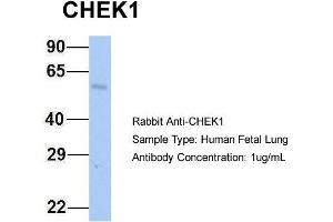 Host: Rabbit Target Name: CHEK1 Sample Type: Human Fetal Lung Antibody Dilution: 1.