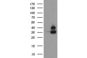 Image no. 1 for anti-OTU Domain, Ubiquitin Aldehyde Binding 1 (OTUB1) antibody (ABIN1499929) (OTUB1 抗体)