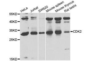 Western blot analysis of extracts of various cell lines, using CDK2 antibody. (CDK2 抗体)