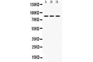 Western blot analysis of KRIT1 expression in rat cardiac muscle extract ( Lane 1), NIH3T3 whole cell lysates ( Lane 2) and HELA whole cell lysates ( Lane 3). (KRIT1 抗体  (C-Term))