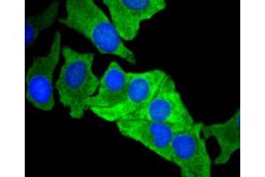 Immunofluorescence analysis of BT-20 cells using MCL1 antibody (ABIN4904325). (MCL-1 抗体)