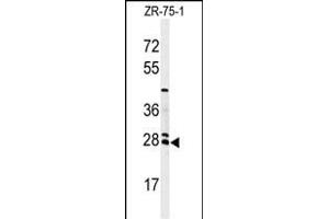 Western blot analysis of NAT8 Antibody (Center) (ABIN651148 and ABIN2840099) in ZR-75-1 cell line lysates (35 μg/lane). (NAT8 抗体  (AA 110-138))