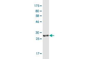 Western Blot detection against Immunogen (29. (UCP1 抗体  (AA 232-267))