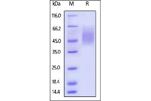 SDS-PAGE (SDS) image for Natural Killer Cell Receptor 2B4 (CD244) (AA 22-221) protein (His tag,AVI tag,Biotin) (ABIN5674581)