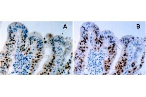 Immunohistochemistry (IHC) image for anti-Tumor Protein P53 (TP53) (AA 378-393), (pSer392) antibody (ABIN487475) (p53 抗体  (pSer392))