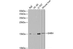 Western blot analysis of extracts of various cell lines using GHRH Polyclonal Antibody at dilution of 1:1000. (GHRH 抗体)