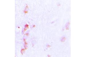 Immunohistochemical analysis of CDCA3 staining in human brain formalin fixed paraffin embedded tissue section. (CDCA3 抗体  (C-Term))
