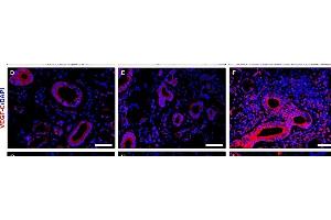 Increased expression of lymphangiogenic mediators in minor salivary glands (MSGs) from patients with primary Sjögren's syndrome (pSS). (VEGFC 抗体  (AA 321-415))
