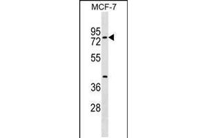 Western blot analysis in MCF-7 cell line lysates (35ug/lane). (TOX4 抗体  (N-Term))