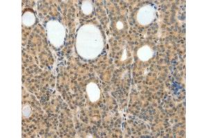 Immunohistochemistry (IHC) image for anti-Neurogenin 3 (NEUROG3) (AA 1-83) antibody (ABIN3016654) (Neurogenin 3 抗体  (AA 1-83))