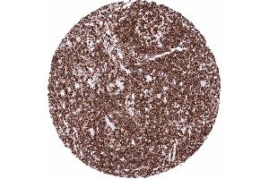 Immunohistochemistry (IHC) image for anti-Protein tyrosine Phosphatase, Receptor Type, C (PTPRC) antibody (ABIN7477413)