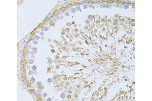 Immunohistochemistry of paraffin-embedded Rat testis using ENO3 Polyclonal Antibody at dilution of 1:100 (40x lens). (ENO3 抗体)