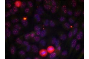 Immunofluorescence staining of methanol-fixed HeLa cells using Elk-1 (phospho-Thr417) antibody. (ELK1 抗体  (pThr417))