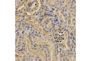 Immunohistochemistry (IHC) image for anti-Proteasome (Prosome, Macropain) 26S Subunit, Non-ATPase, 9 (PSMD9) antibody (ABIN1876545) (PSMD9 抗体)