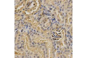 Immunohistochemistry (IHC) image for anti-Proteasome (Prosome, Macropain) 26S Subunit, Non-ATPase, 9 (PSMD9) antibody (ABIN1876545) (PSMD9 抗体)