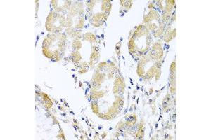 Immunohistochemistry of paraffin-embedded human stomach using ACAD9 antibody at dilution of 1:100 (x40 lens). (ACAD9 抗体)