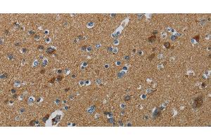 Immunohistochemistry of paraffin-embedded Human brain tissue using PPARGC1B Polyclonal Antibody at dilution 1:30 (PPARGC1B 抗体)