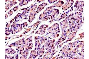 Immunohistochemistry (IHC) image for anti-serine Peptidase Inhibitor, Kazal Type 1 (SPINK1) (AA 19-79) antibody (ABIN7168925)
