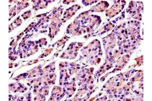 Immunohistochemistry of paraffin-embedded human pancreatic tissue using ABIN7168925 at dilution of 1:100 (SPINK1 抗体  (AA 19-79))