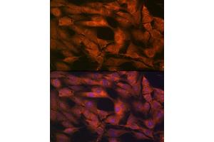Immunofluorescence analysis of C6 cells using Laminin beta 1 Rabbit mAb (ABIN7268185) at dilution of 1:100 (40x lens). (Laminin beta 1 抗体)