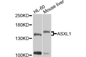 Western blot analysis of extracts of various cells, using ASXL1 antibody.