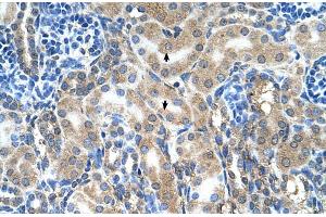 Rabbit Anti-ABP1 Antibody ,Paraffin Embedded Tissue: Human Kidney  Cellular Data: Epithelial cells of renal tubule  Antibody Concentration: 4. (DAO 抗体  (C-Term))