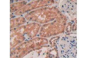 IHC-P analysis of kidney tissue, with DAB staining. (Col4a4 抗体  (AA 1469-1690))