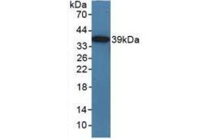 Western blot analysis of recombinant Mouse TICAM1. (TICAM1 抗体  (AA 263-526))