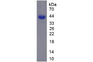 SDS-PAGE analysis of Human PFKL Protein. (PFKL 蛋白)