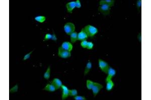 Immunofluorescence staining of SH-SY5Y cells with ABIN7148040 at 1:100, counter-stained with DAPI. (Codanin 1 (CDNA1) (AA 62-249) 抗体)
