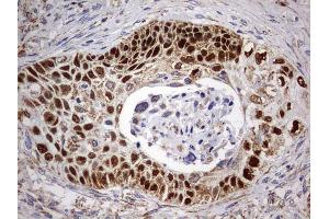 Immunohistochemistry (IHC) image for anti-Tumor Protein P63 (TP63) antibody (ABIN2673817) (p63 抗体)
