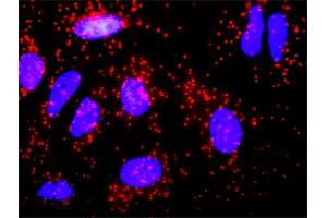 Proximity Ligation Analysis of protein-protein interactions between CALR and F8. (Factor VIII 抗体  (AA 213-312))