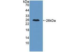 Detection of Recombinant IL34, Mouse using Polyclonal Antibody to Interleukin 34 (IL34)