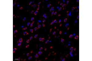 Immunofluorescence of paraffin embedded mouse brain using PTPN12 (ABIN7075292) at dilution of 1: 1000 (400x lens) (PTPN12 抗体)