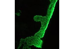 Image no. 2 for anti-pan Keratin (panKRT) antibody (ABIN959483) (pan Keratin 抗体)